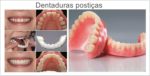Prótese dentária